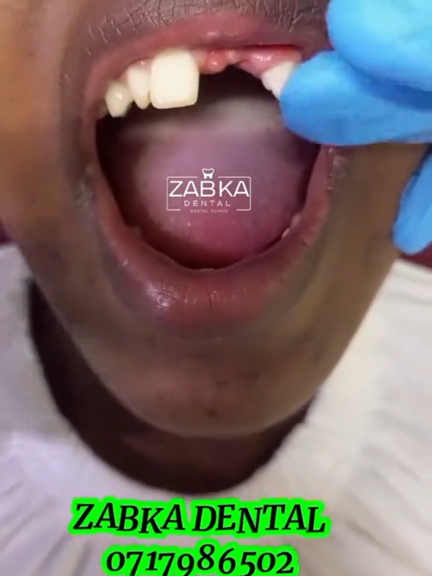 @Zabka Dental