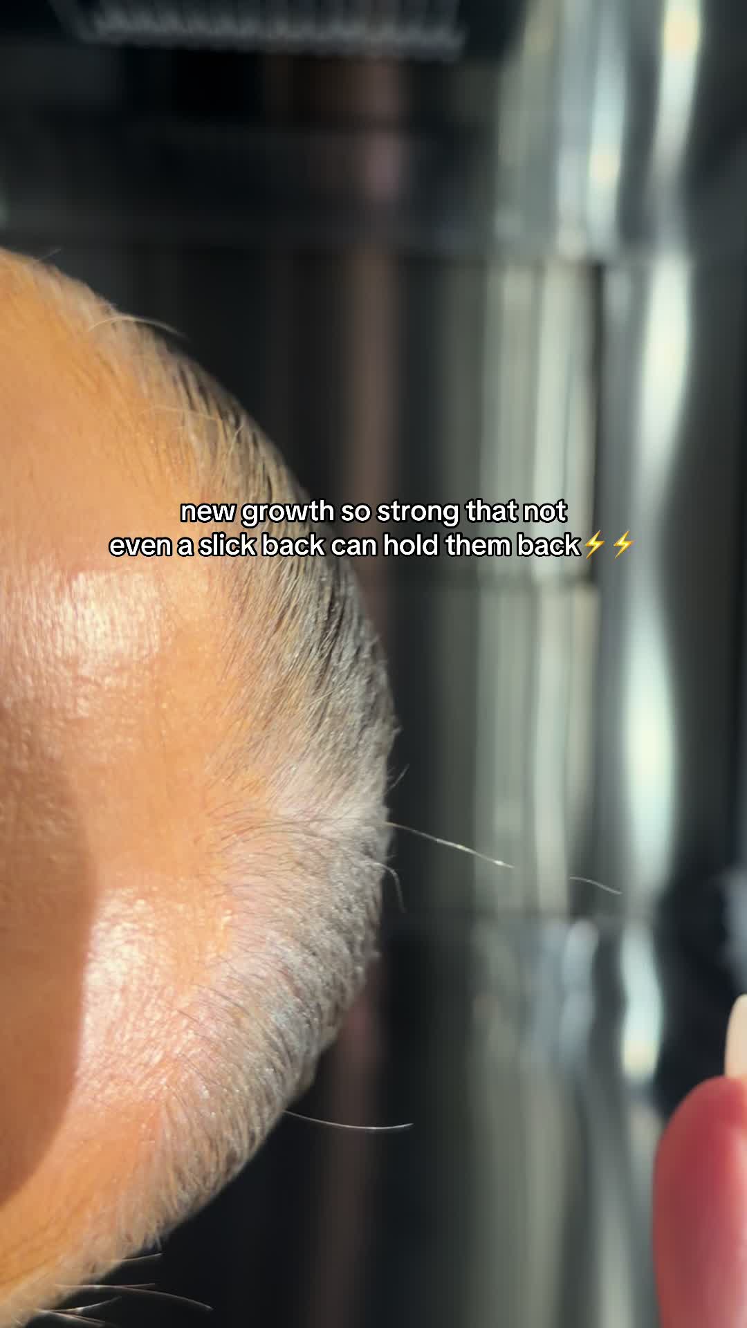 @hairsyrup