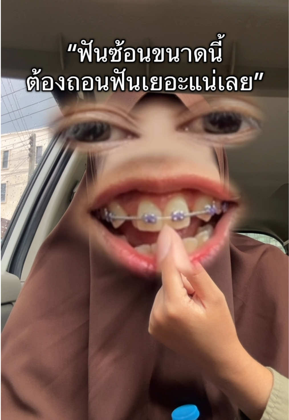 @ฟาตินฟันกระต่ายอ้ะะ🐰