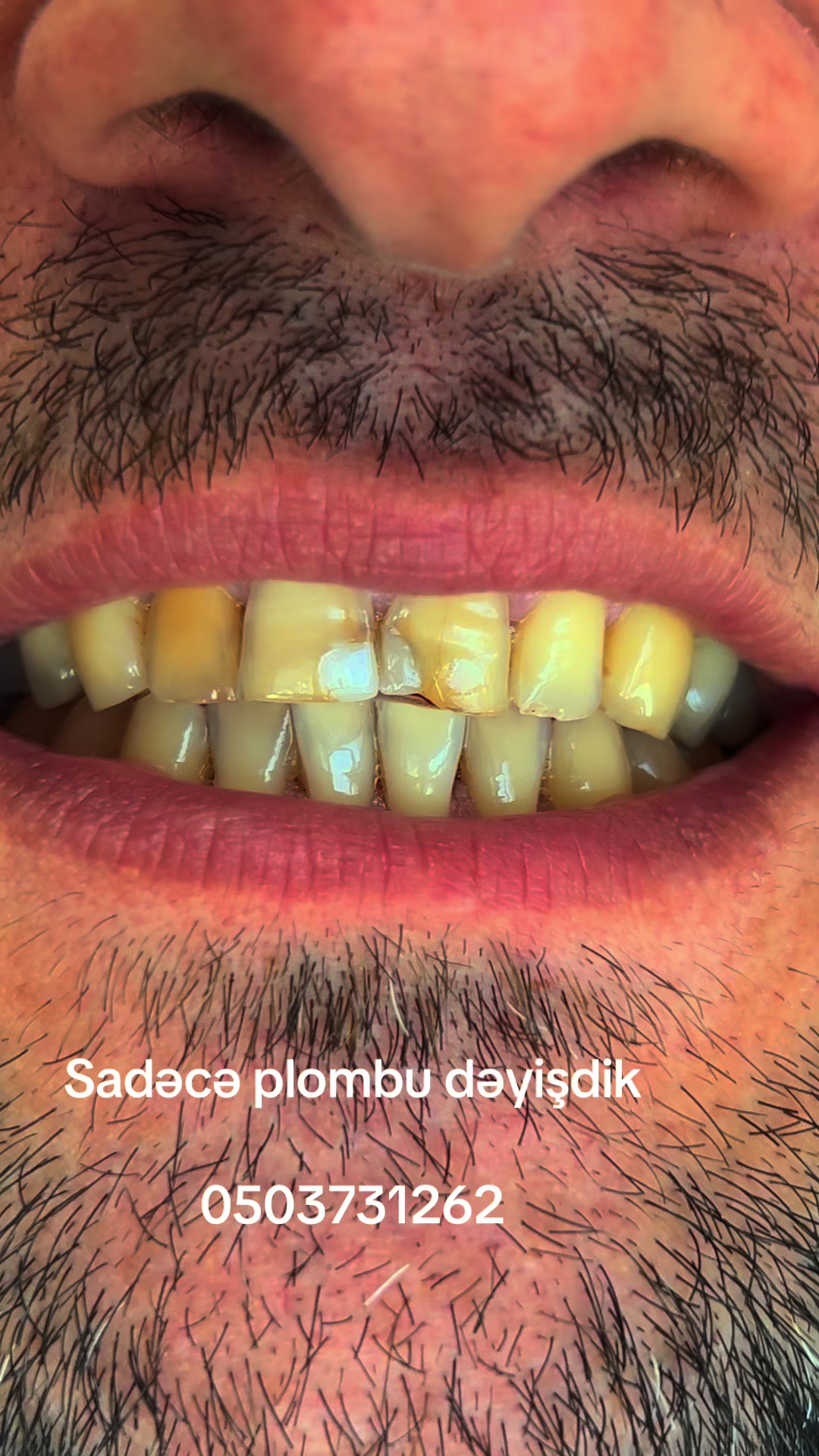 @Dr Oruc Huseynli