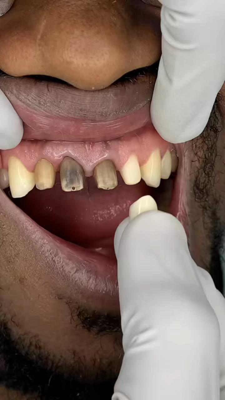 @drhelina_smile_architect
