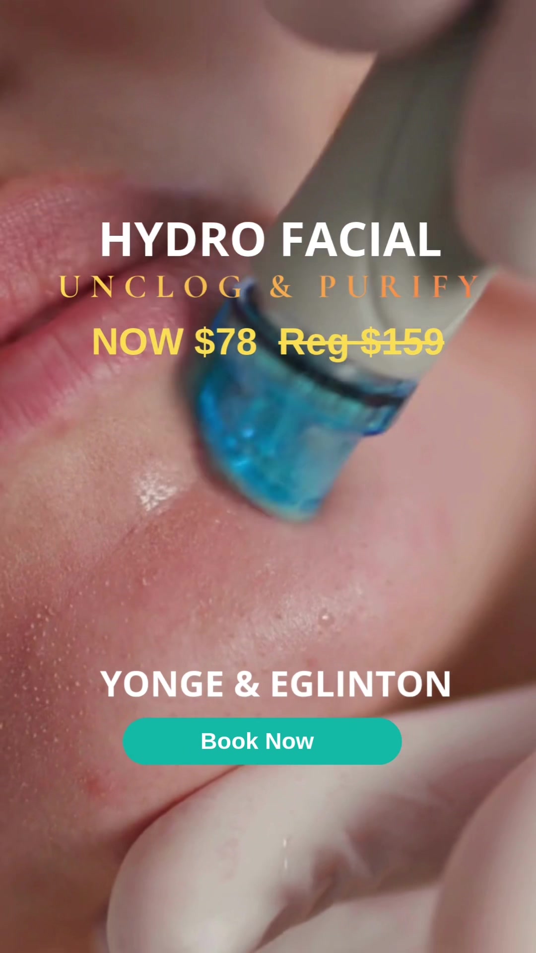 @Vitality Medspa • Yonge & Eg