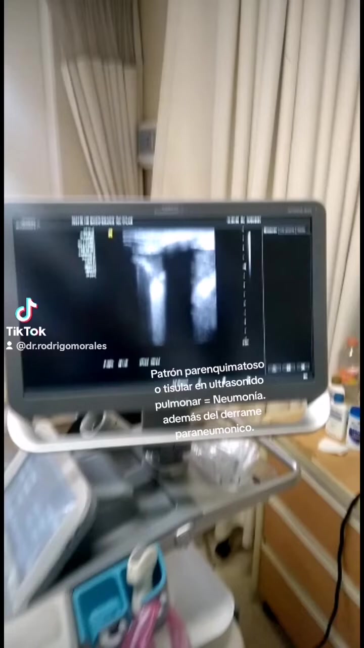 @Dr. Ajolote.