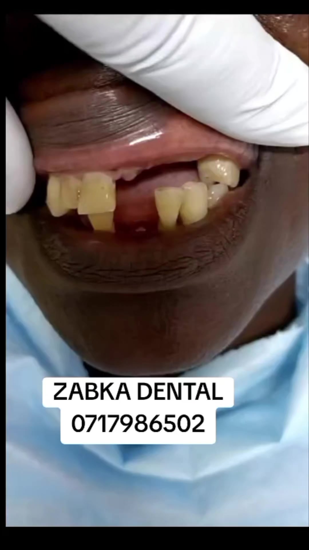 @Zabka Dental