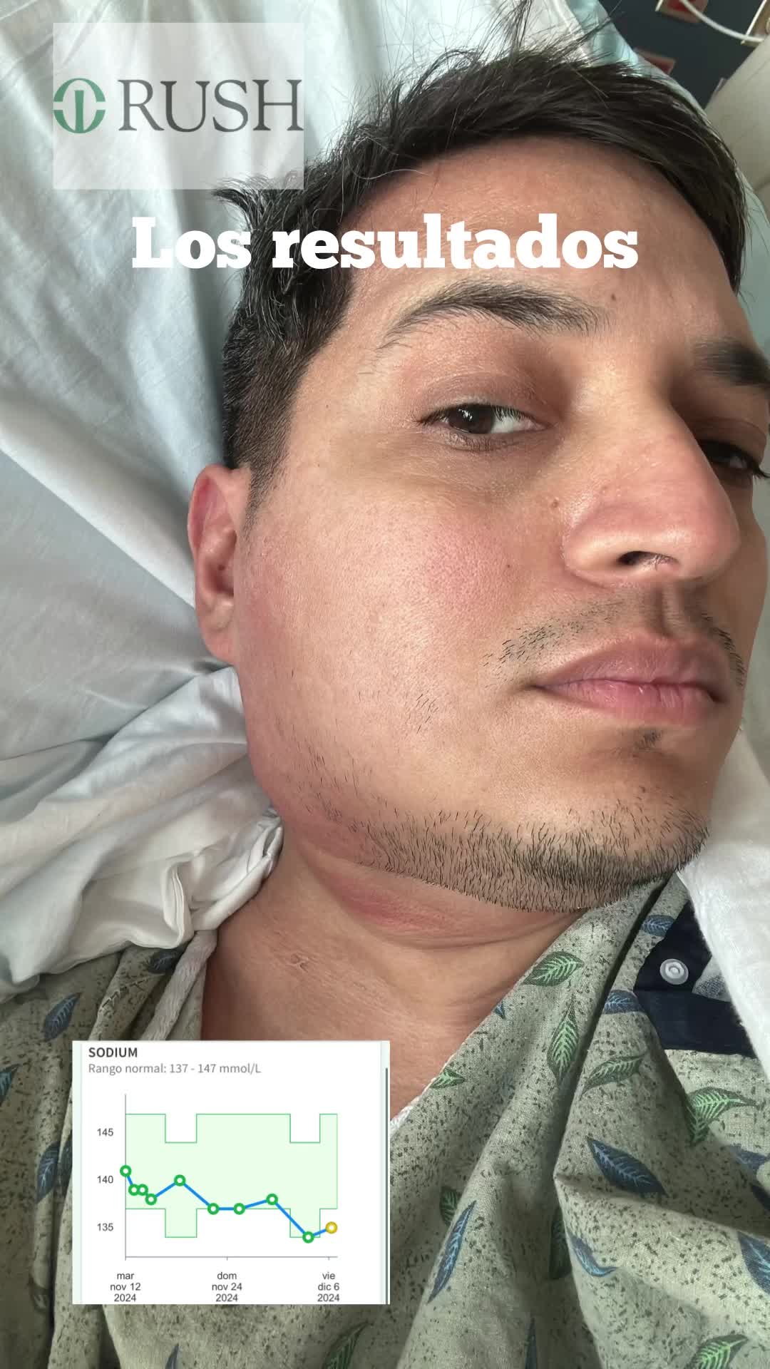 @Angel Gomez Linfoma