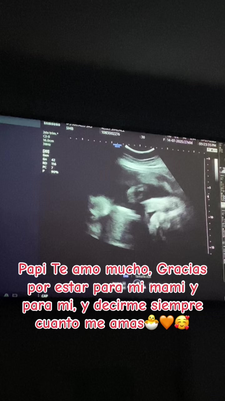 @Kelly Jim&eacute;nez