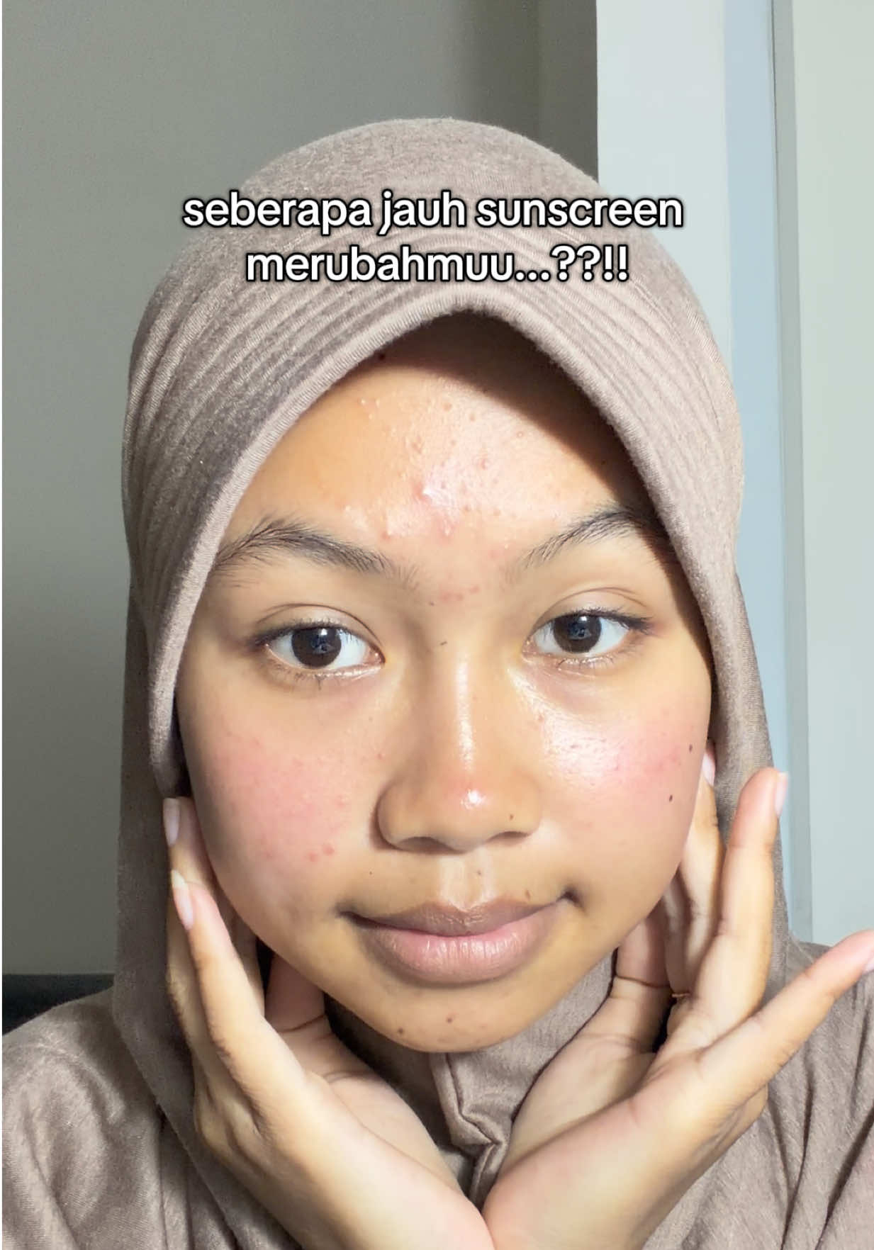 @Ini rika