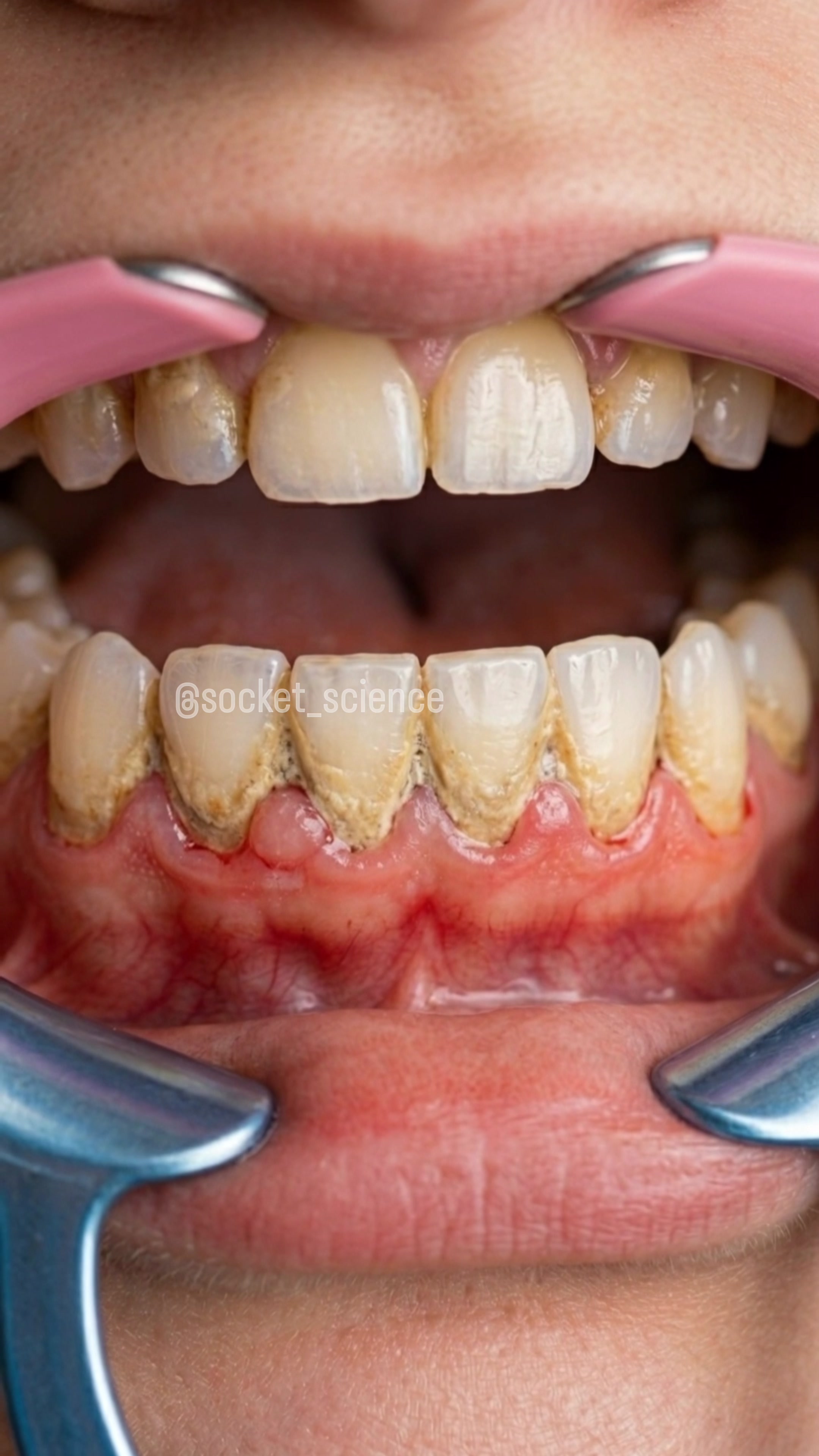 @Socket Science | Dental Visual