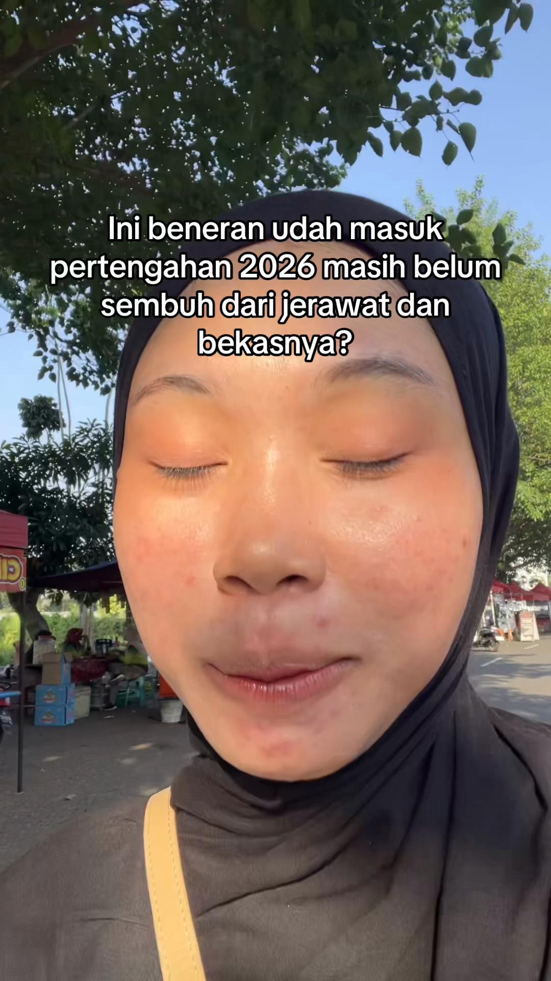 @Nina Marselina