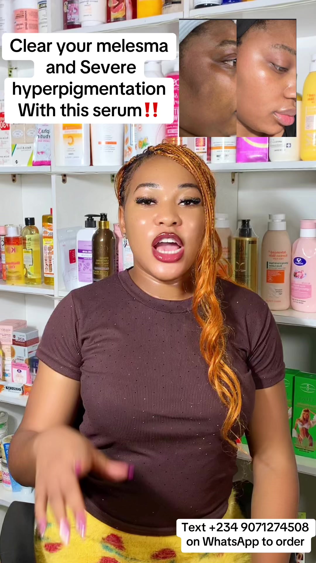 @BEST LIPCARE /SKINCARE BRAND