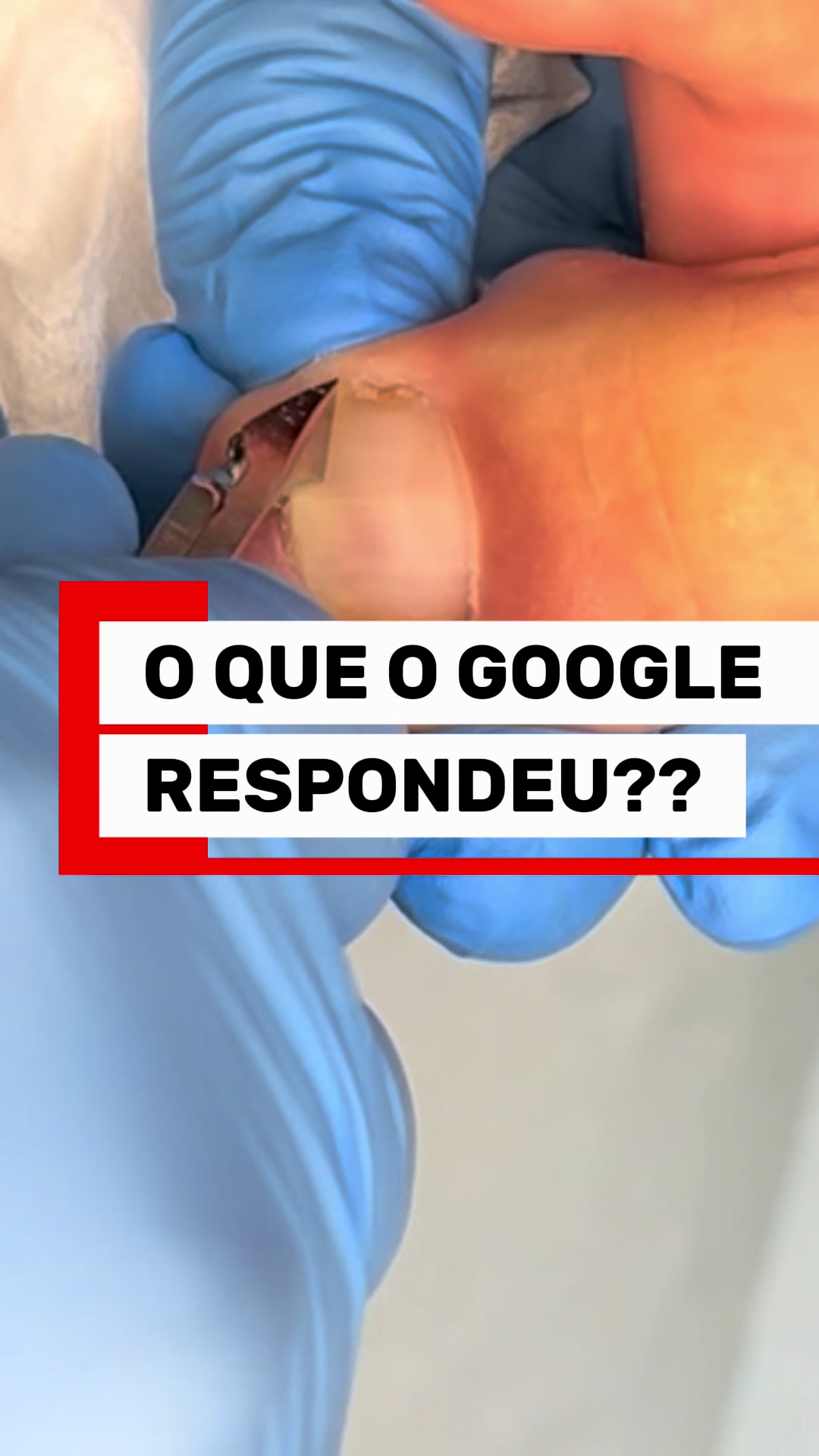 @Podocurebr