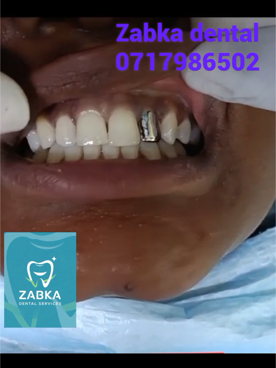 @Zabka Dental