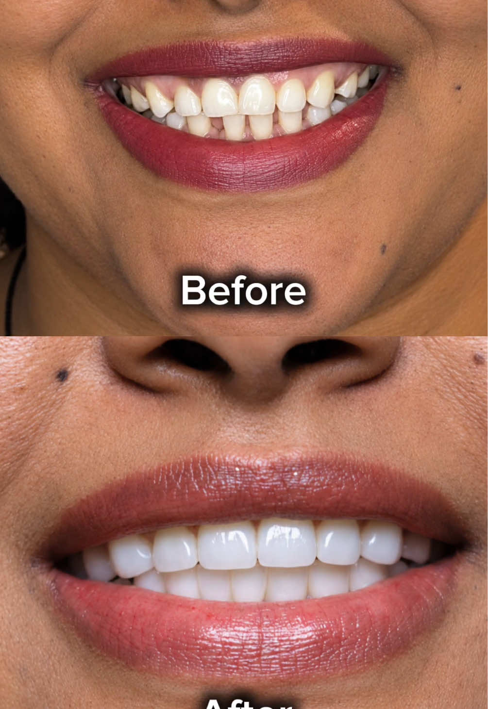@drhelina_smile_architect