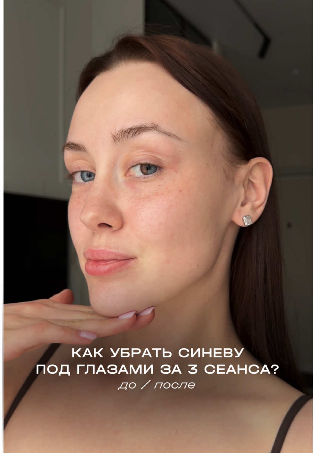 @MED YU MED
