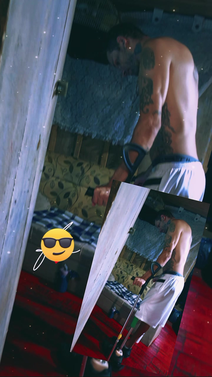 @Henrique amputado🦿