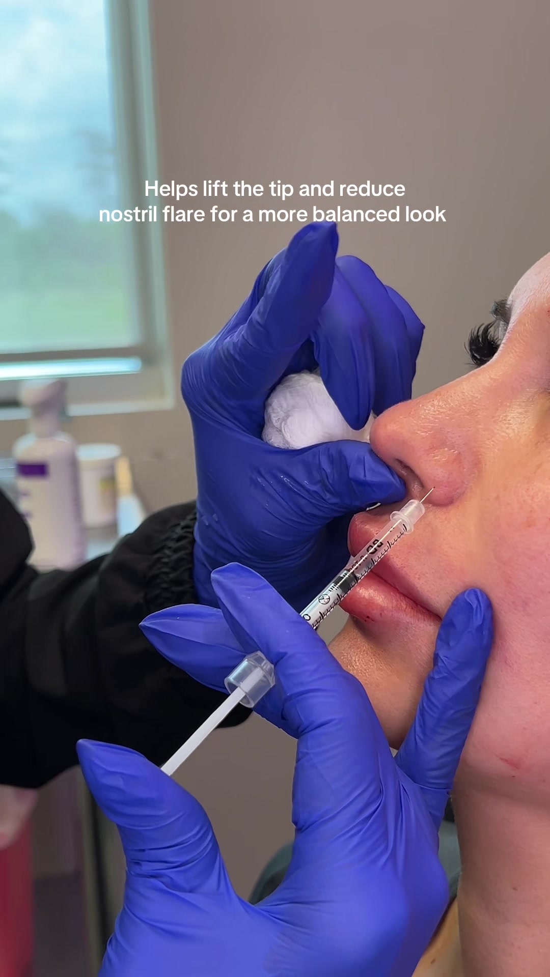 @Vanessa Injects