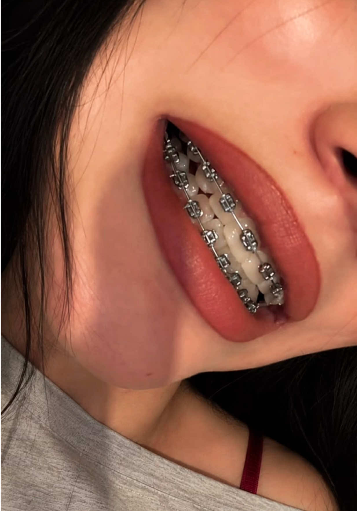 @Pure Orthodontics