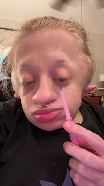 @Abby♿️