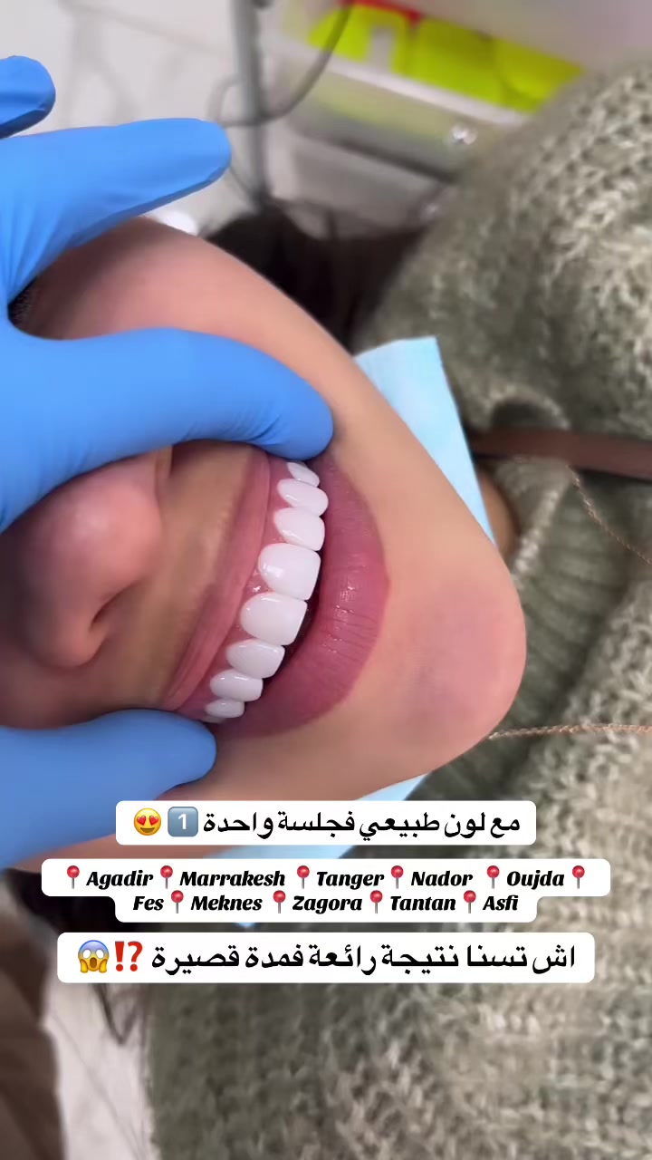 @brightsmileee1