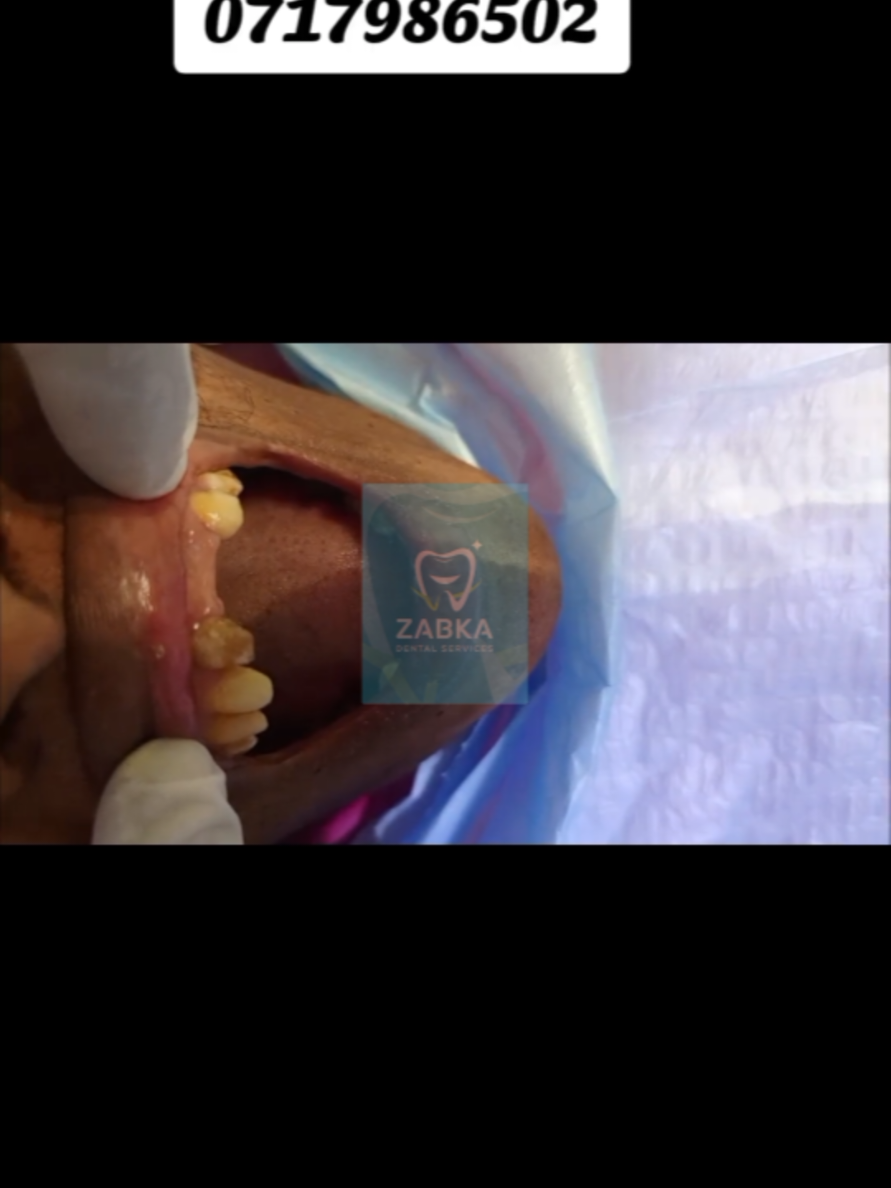 @Zabka Dental