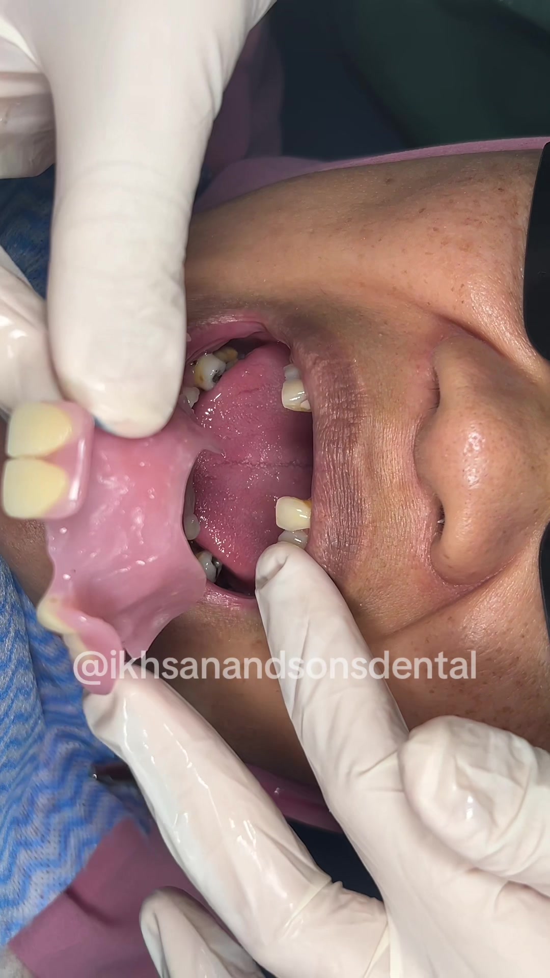 @Ikhsan & Sons Dental 🦷