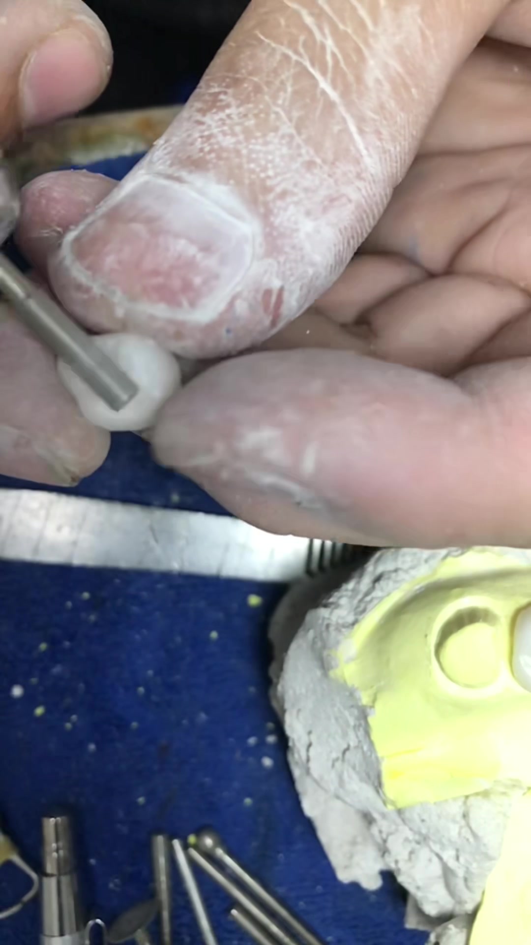 @Hùng răng sứ 🦷🦷