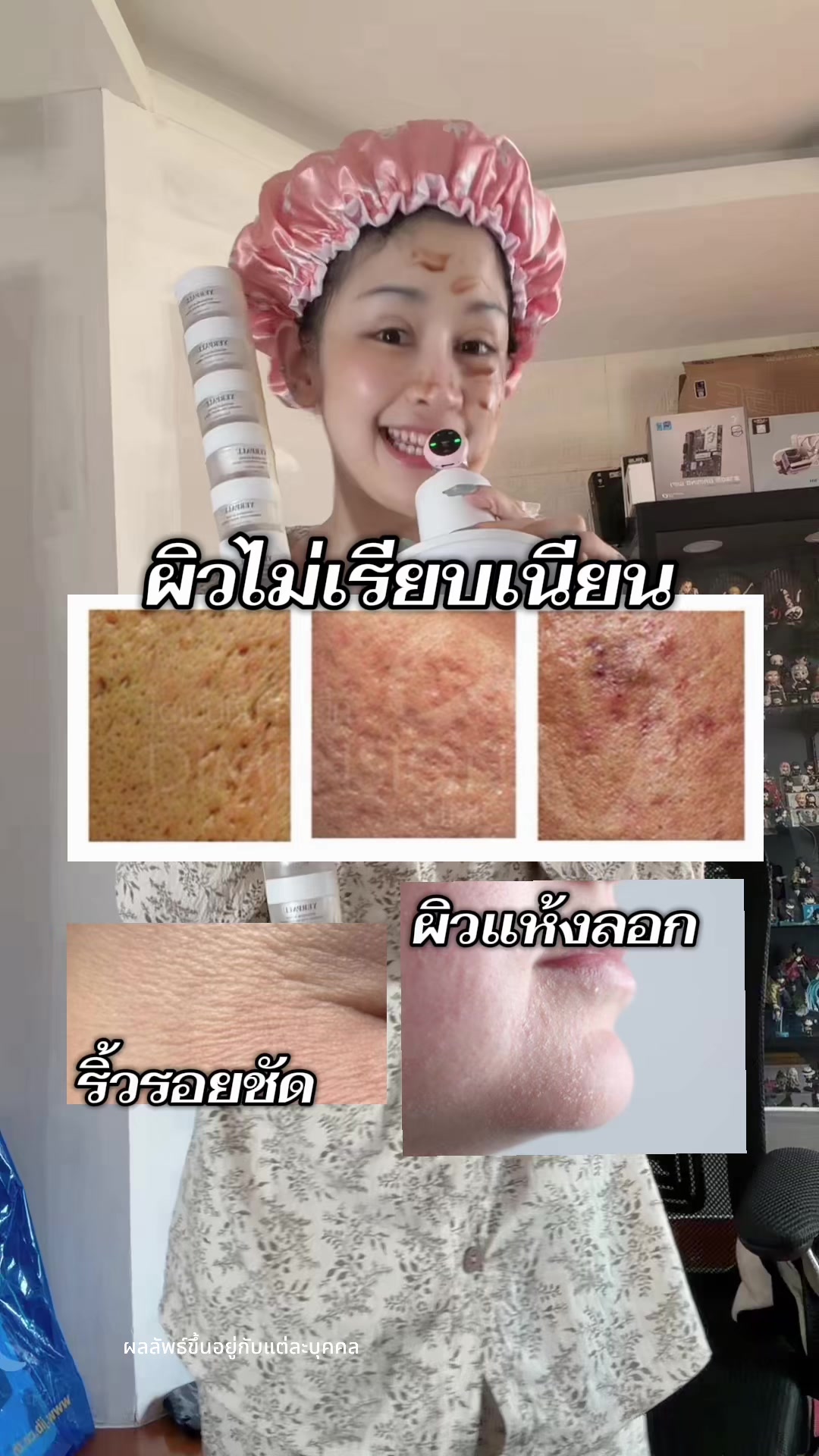 @ฝน สิจะได้คม🔪