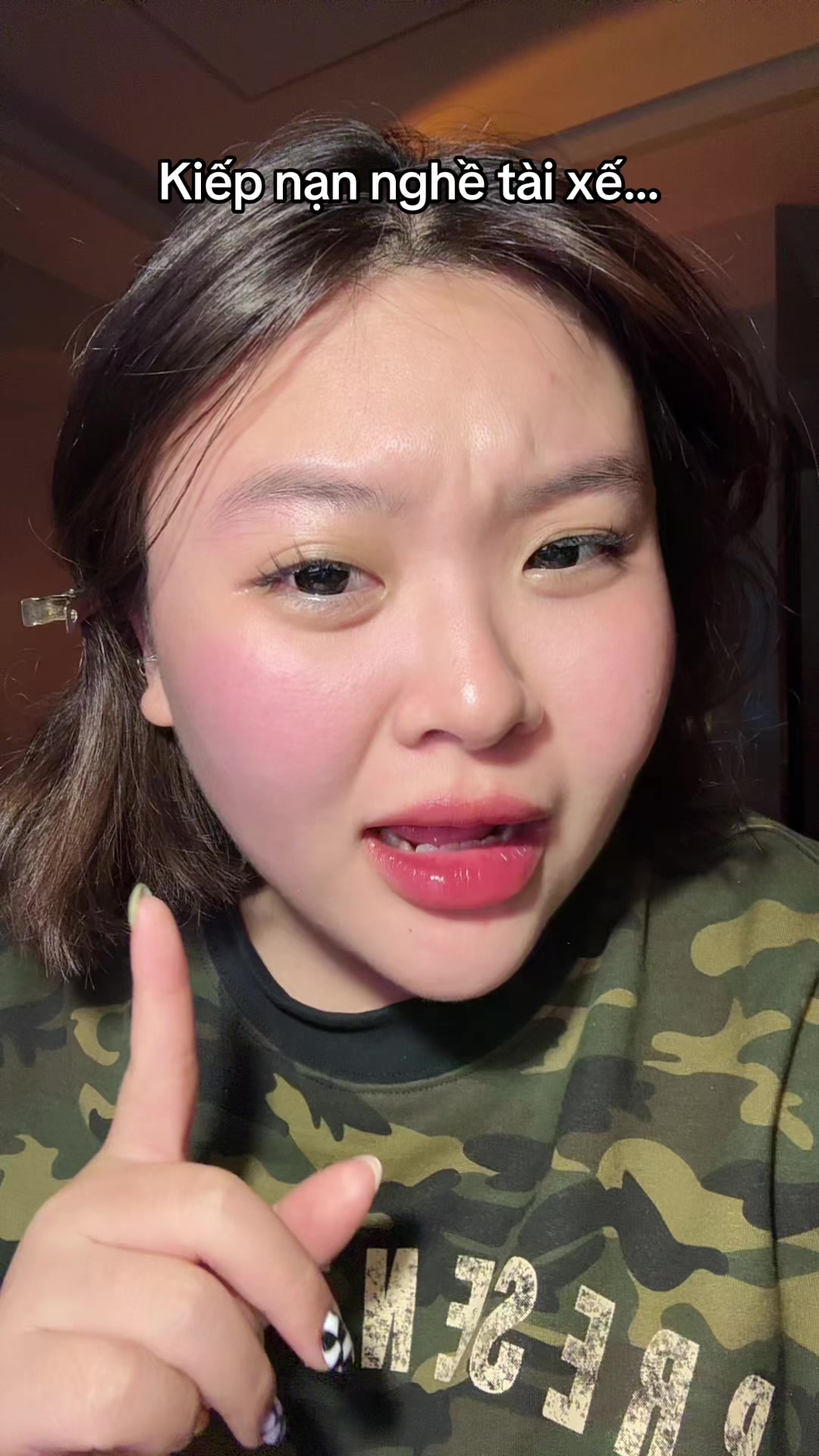 @Đu Đu sún răng