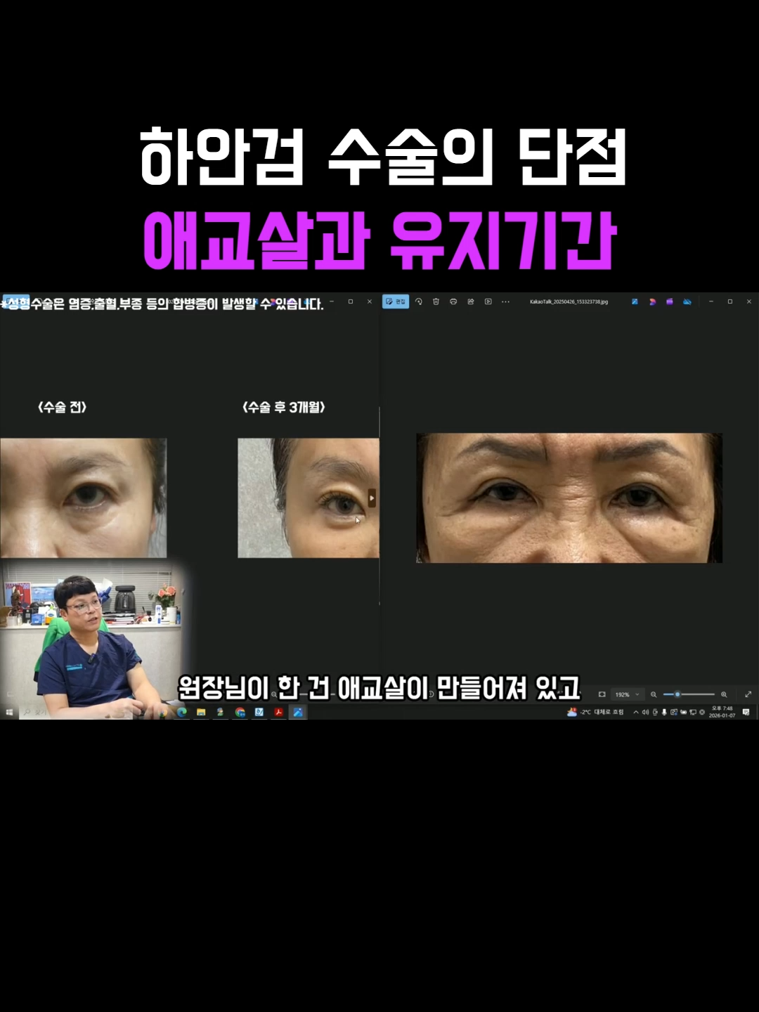 @미오름성형외과
