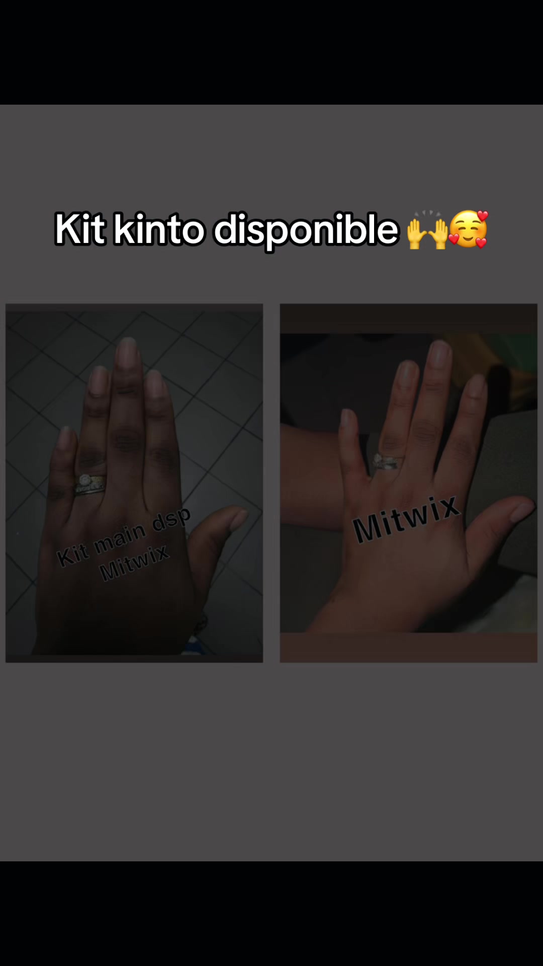 @Mitwix Yaba Vibra