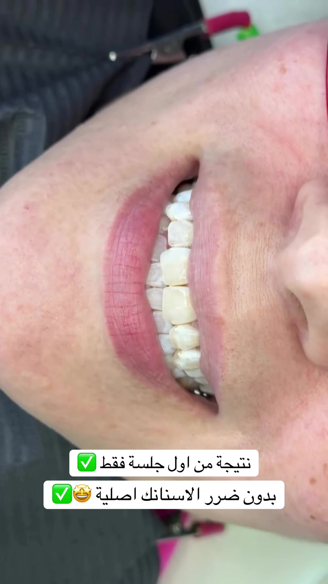 @brightsmileee1