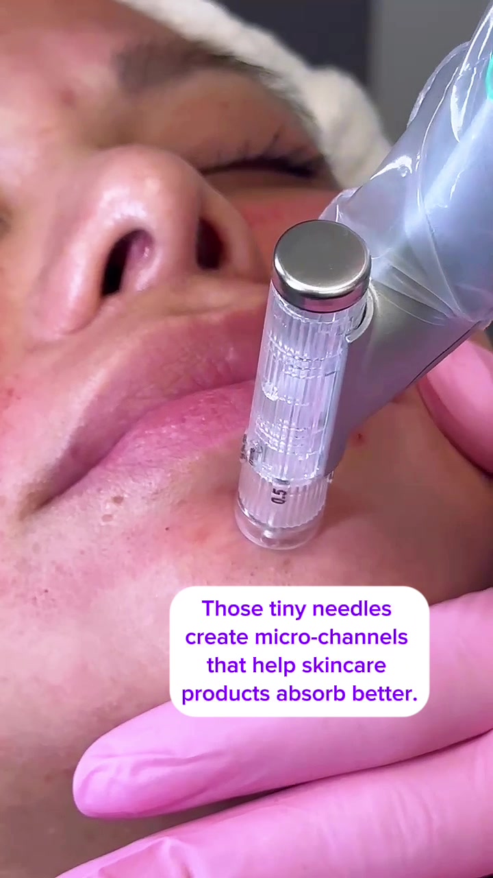 @Rosedermnyc