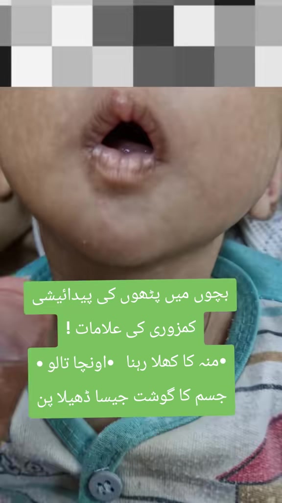 @Dr Arshad Child Neurologist