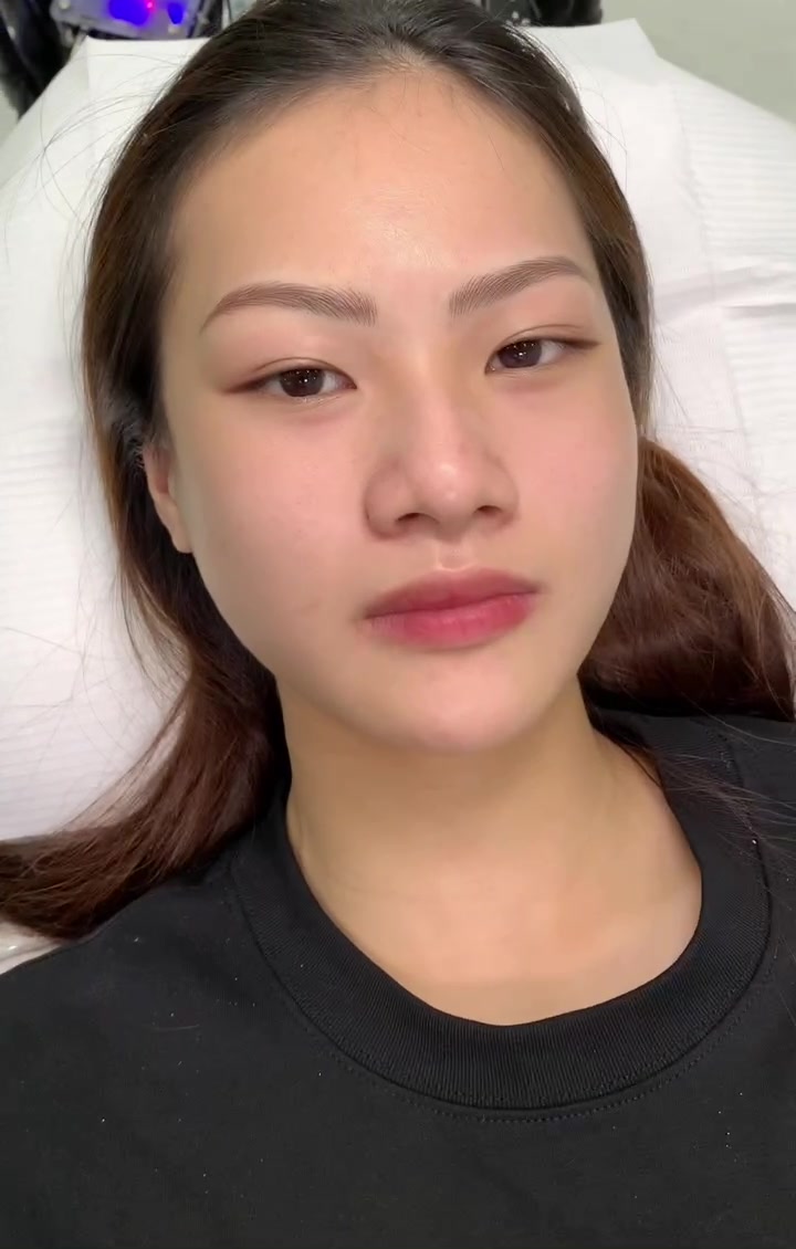 @Viện Thẩm Mỹ Hena