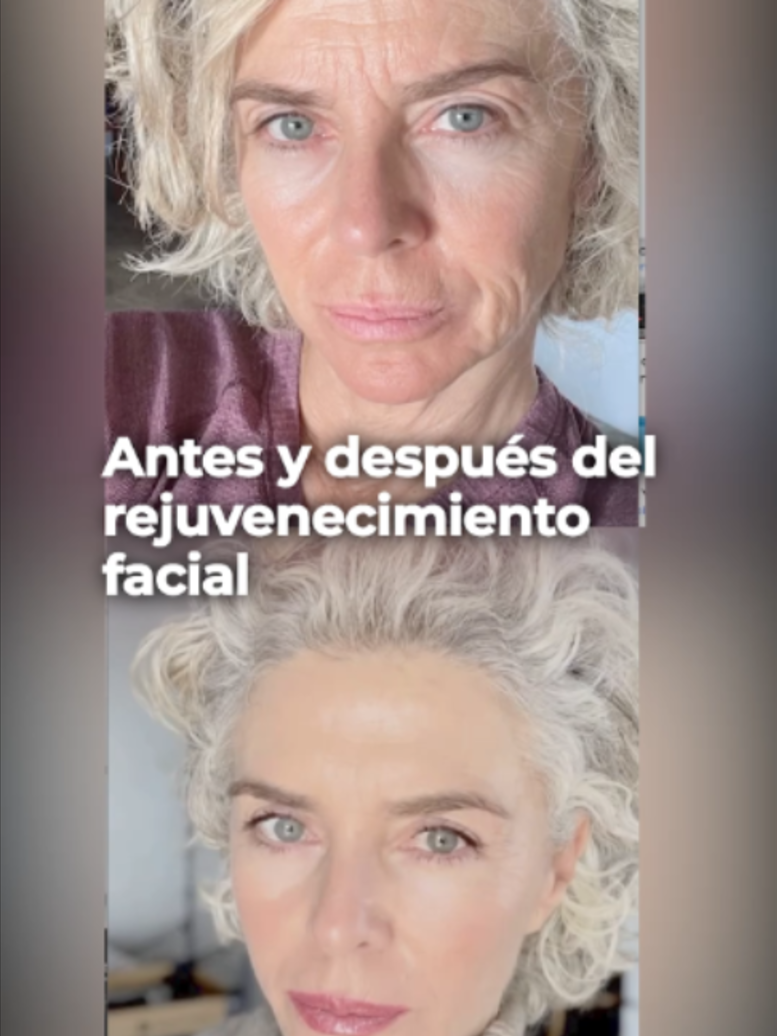 @Famosos