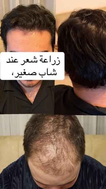 @Dr. Ahmed Alkhateeb