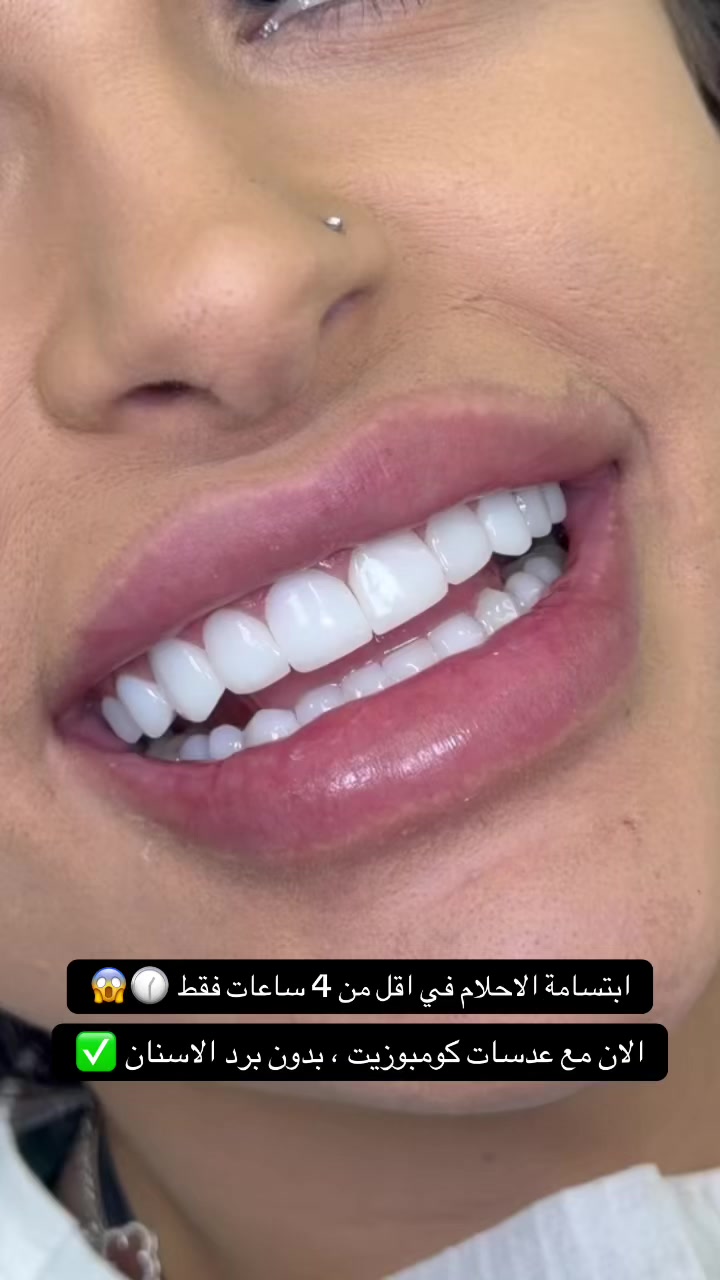 @brightsmileee1