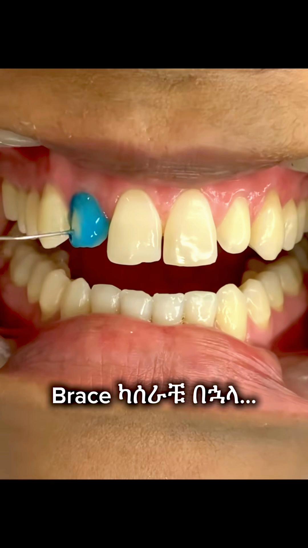@drhelina_smile_architect