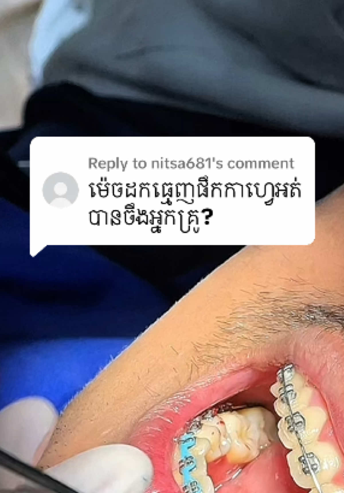@BRIGHT SMILE DENTAL HOSPITAL