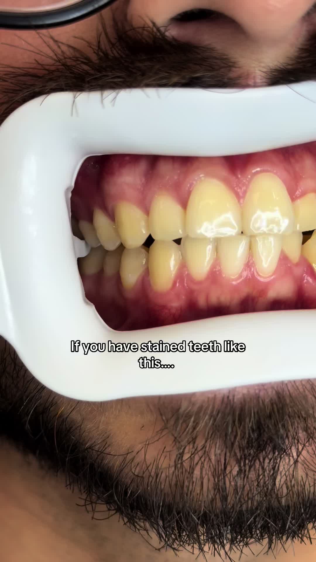 @Queenofthemouth