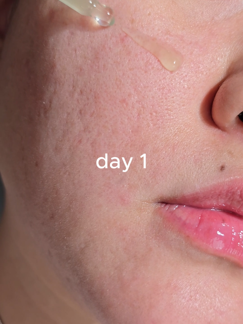 @CHOMI | Korean Skincare