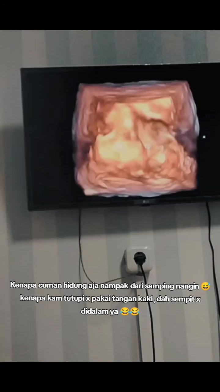 @KarjuTopan