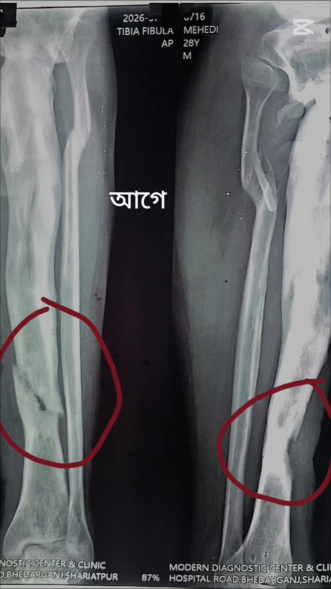 @Mehedi তালুকদার