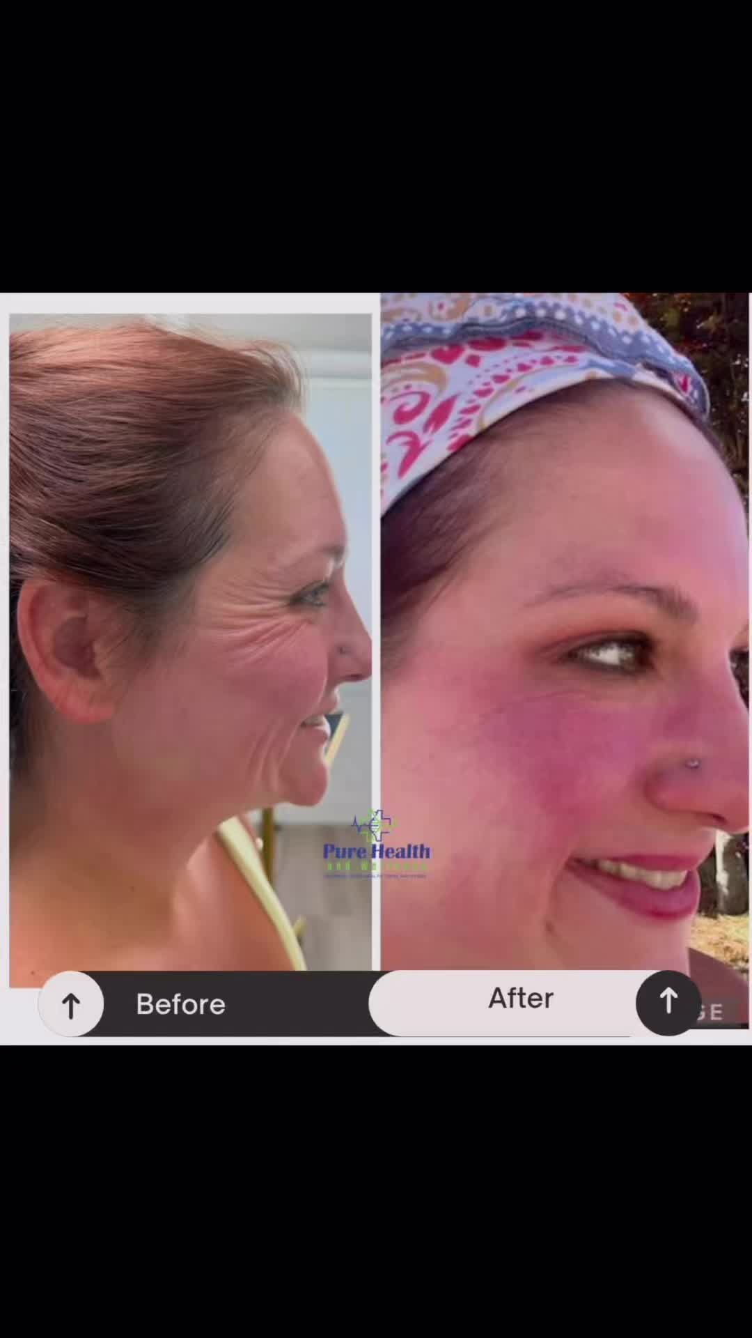 @PureHealthand_Wellness