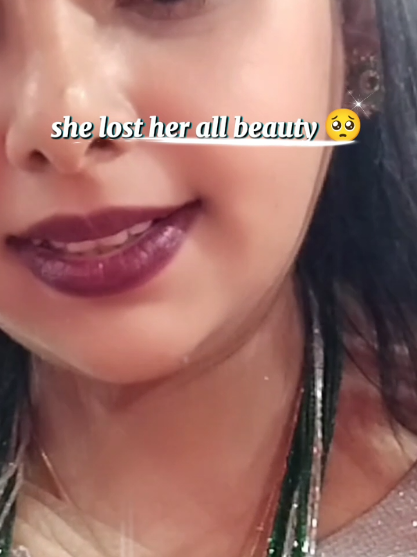 @jyoti smile