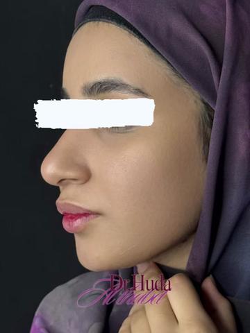 @Drhuda98