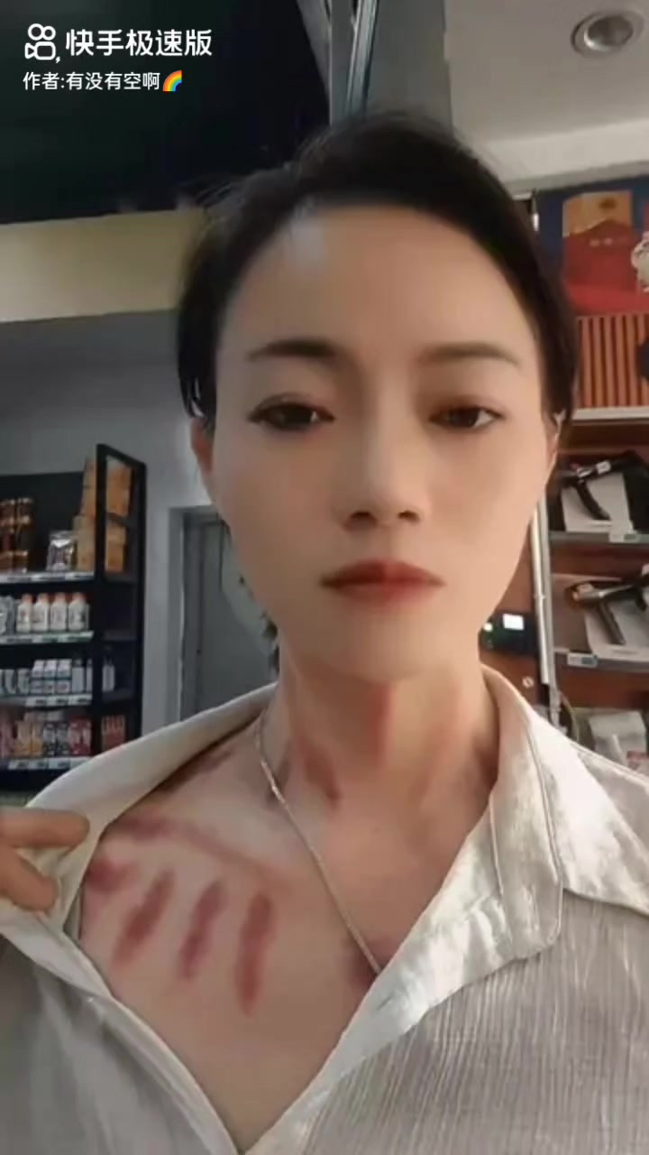 @thích cạo gió