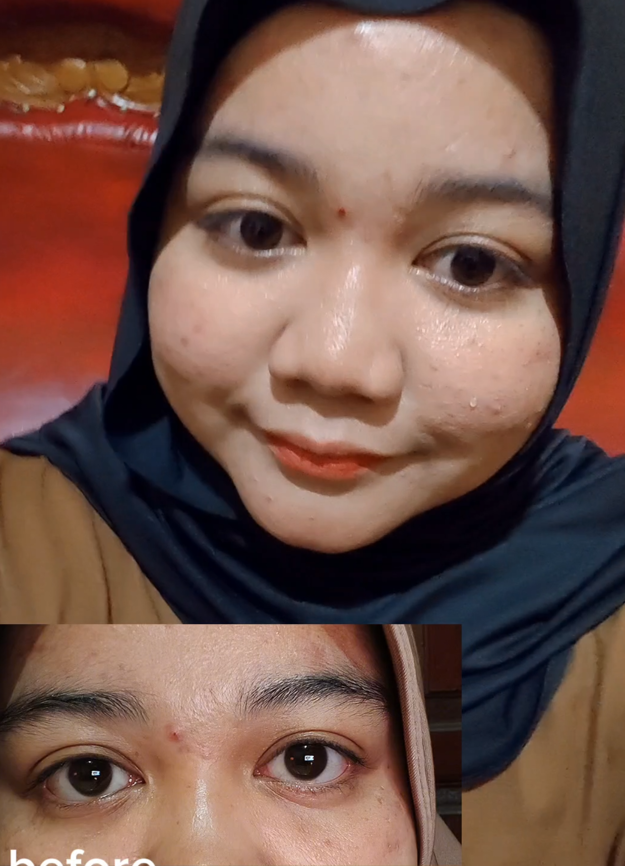 @ubur-ubur🪼