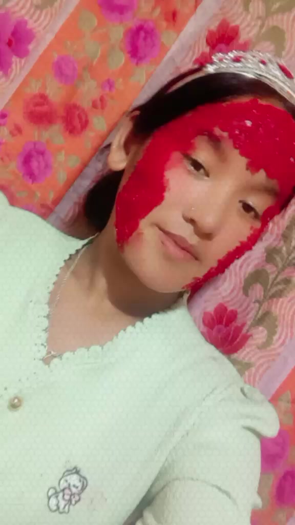 @Ganga Rokaya10๐๐