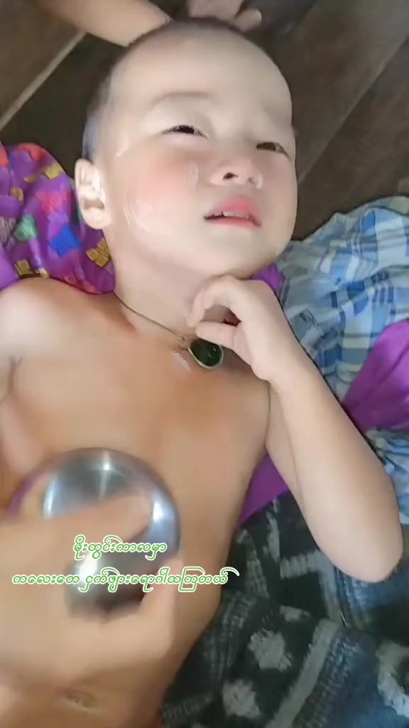 @๐ธ๐๐ (๐ถ๐๐๐๐๐๐๐)